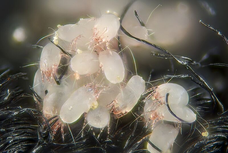 House dust mites (5247397771)