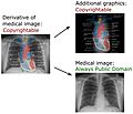 Derivative of medical imaging