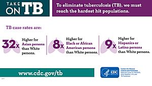 CDC TB graphic on minority groups being impacted by TB