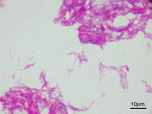 Mycobacterium bovis BCG ZN