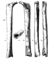 Sinanthropus Femur IV