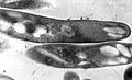 Mycobacterium tuberculosis 01