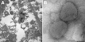 Electron micrograph of poxvirus particles in synovium of a big brown bat and negative staining of poxvirus particles in cell culture supernatant