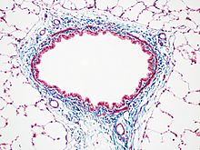Masson's Trichrome Stain (Rat Airway Section)