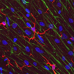 Microglial cells (red) in rat cerebellar molecular layer