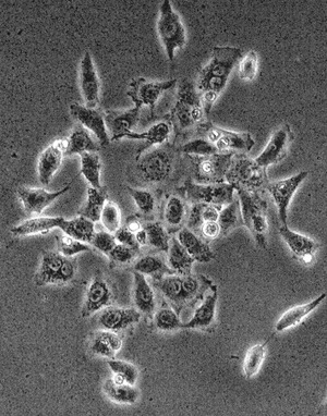 HEK 293 cells grown in tissue culture medium