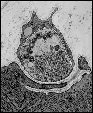 HeuserNeuro