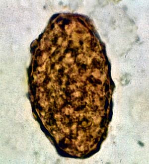 Ascaris lumbricoides non-fertile egg