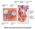 Blausen 0459 Heart VentriclesContract