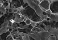 DDC-SEM of calcified particle in cardiac tissue - BW - 1