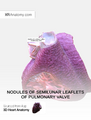 Nodules of semilunar leaflets of pulmonary valve