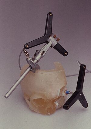 StereolithographiemodellSchaedel