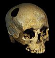 Trepanated skull of a woman-P4140363-black