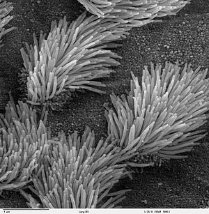 Bronchiolar epithelium 3 - SEM