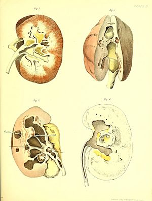 Obadiah Short - Plate 3 from 'A treatise on the formation, constituents, and extraction of the urinary calculus'