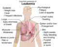 Symptoms of leukemia
