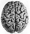03 2 facies dorsalis cerebri gyri