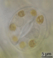Tomato stoma observed through immersion oil