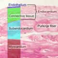 Endocardium and subendocardium histology