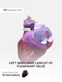 Left semilunar leaflet of pulmonary valve