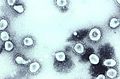 TEM of coronavirus OC43