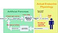 Artificial Pancreas