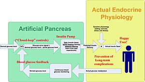 Artificial Pancreas