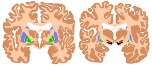 Basal ganglia