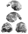 Sinanthropus Skull X