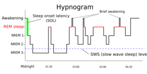 Sleep Hypnogram