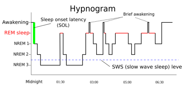 Sleep Hypnogram