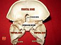 Sphenoid and temporal bones 4