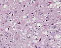 Pathogen Facts for Kids