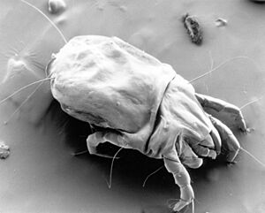 CSIRO ScienceImage 11085 A scanning electron micrograph of a female dust mite