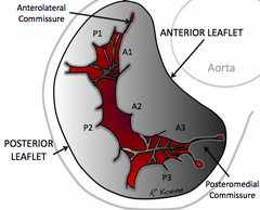 Mitral Valve RK