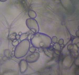 Potato - Amyloplasts