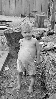 Sharecropper's child suffering from rickets and malnutrition, Wilson cotton plantation, Mississippi County, Arkansas, LC-USF33-002002-M2 (6288133677) (cropped)