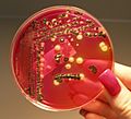 Salmonella growing on XLD agar