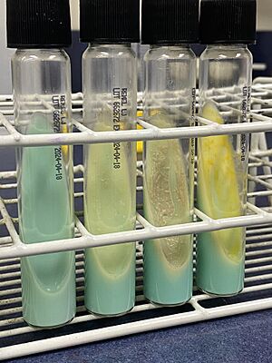 Slant tubes of Löwenstein-Jensen medium with control, M tuberculosis, M avium and M gordonae