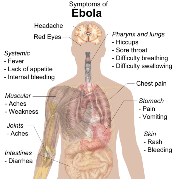 Symptoms of ebola