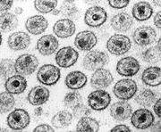 HIV-1 Transmission electron micrograph AIDS02bbb lores