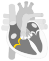 Tricuspid valve * Válvula tricúspide