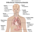 Main symptoms of Infectious mononucleosis