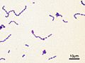 blue stain of Streptococcus mutans