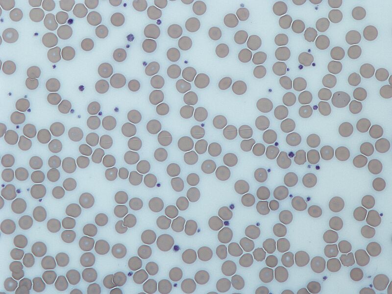 Platelets2