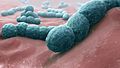 Streptococcus pneumoniae - A causative bacteria of meningitis