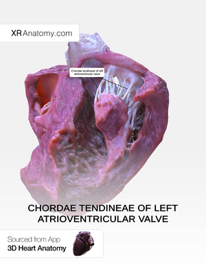 Chordae tendineae of left atrioventricular valve