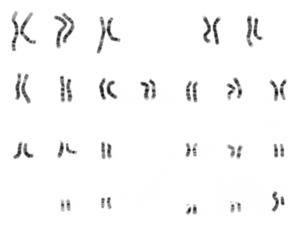 NHGRI human male karyotype