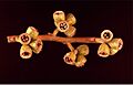 Eucalyptus kondininensis fruit