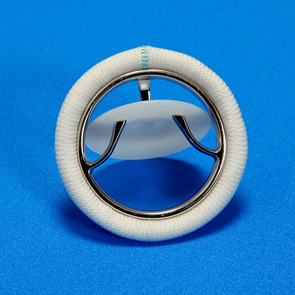 Chitra Valve